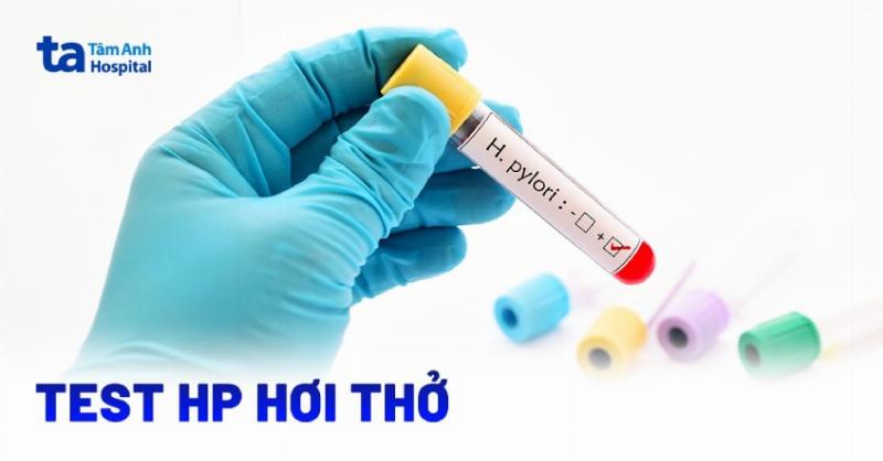 Test Hơi Thở HP Có Phải Nhịn Ăn Không? Giải Đáp Chi Tiết Từ Chuyên Gia